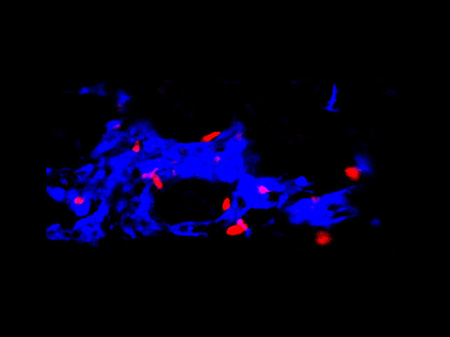 Tumor-reactive T cell can mediate tumor control and are a predicative marker for immunotherapy efficacy. The Spranger lab is interested in understanding the factors mediating T cell exclusion from the tumor microenvironment.