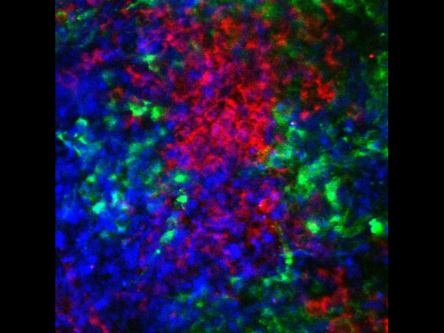 Studying the tumor-immune microenvironment. The Spranger lab is interested in understanding the interactions between immune cells and tumor cells on local and system levels.