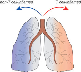 Lung schematic